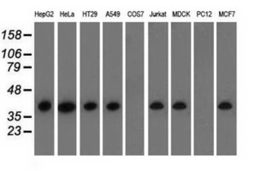Anti-HIBCH antibody [3H5] used in Western Blot (WB). GTX84364