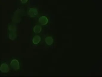 Anti-Hex antibody [3C4] used in Immunocytochemistry/ Immunofluorescence (ICC/IF). GTX84372