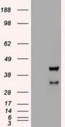 Anti-Hex antibody [3E6] used in Western Blot (WB). GTX84374