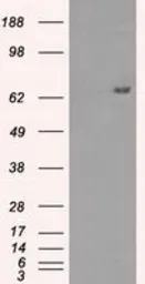 Anti-HDAC10 antibody [6D4] used in Western Blot (WB). GTX84382