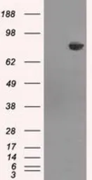 Anti-HDAC10 antibody [2H6] used in Western Blot (WB). GTX84387