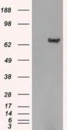Anti-HDAC10 antibody [3C2] used in Western Blot (WB). GTX84388