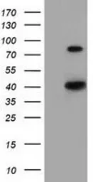 Anti-HAO1 antibody [3E7] used in Western Blot (WB). GTX84392