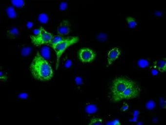 Anti-H6PD antibody [1H6] used in Immunocytochemistry/ Immunofluorescence (ICC/IF). GTX84394