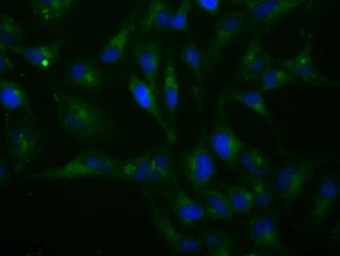 Anti-H6PD antibody [1H6] used in Immunocytochemistry/ Immunofluorescence (ICC/IF). GTX84394