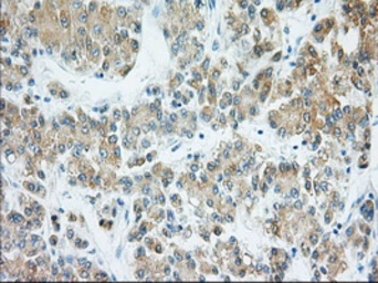 Anti-H6PD antibody [1H6] used in IHC (Paraffin sections) (IHC-P). GTX84394