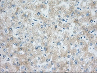 Anti-H6PD antibody [1H6] used in IHC (Paraffin sections) (IHC-P). GTX84394