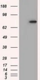 Anti-H6PD antibody [1H6] used in Western Blot (WB). GTX84394