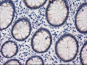 Anti-GSS antibody [1A12] used in IHC (Paraffin sections) (IHC-P). GTX84406