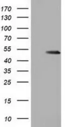 Anti-GSS antibody [1A12] used in Western Blot (WB). GTX84406