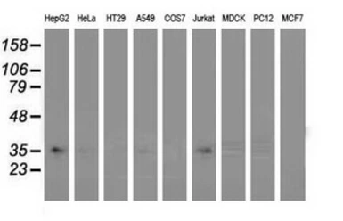 Anti-GRHPR antibody [4H2] used in Western Blot (WB). GTX84413