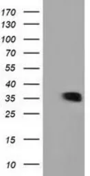 Anti-GRHPR antibody [4H2] used in Western Blot (WB). GTX84413