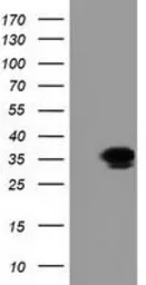 Anti-GRHPR antibody [4B6] used in Western Blot (WB). GTX84415