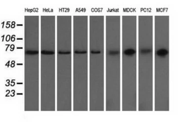 Anti-GRASP65 antibody [5G8] used in Western Blot (WB). GTX84424