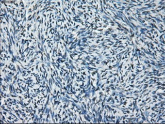 Anti-Glutamine synthetase antibody [1F4] used in IHC (Paraffin sections) (IHC-P). GTX84426