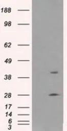 Anti-Glutamine synthetase antibody [1F4] used in Western Blot (WB). GTX84426