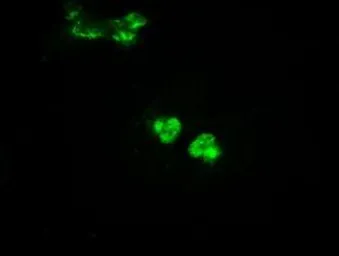 Anti-Glucokinase antibody [3E3] used in Immunocytochemistry/ Immunofluorescence (ICC/IF). GTX84440