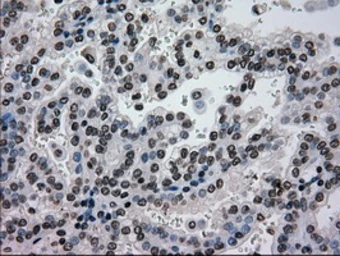 Anti-Glucokinase antibody [3E3] used in IHC (Paraffin sections) (IHC-P). GTX84440