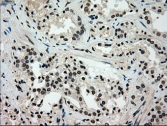 Anti-Glucokinase antibody [3E3] used in IHC (Paraffin sections) (IHC-P). GTX84440