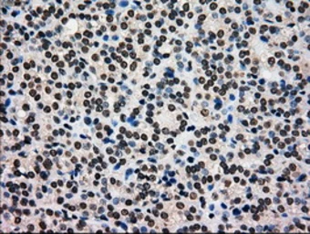 Anti-Glucokinase antibody [3E3] used in IHC (Paraffin sections) (IHC-P). GTX84440