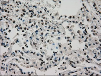 Anti-Glucokinase antibody [3E3] used in IHC (Paraffin sections) (IHC-P). GTX84440