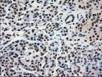 Anti-Glucokinase antibody [3E3] used in IHC (Paraffin sections) (IHC-P). GTX84440
