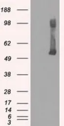 Anti-Glucokinase antibody [3E3] used in Western Blot (WB). GTX84440