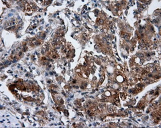 Anti-GBE1 antibody [3B4] used in IHC (Paraffin sections) (IHC-P). GTX84456
