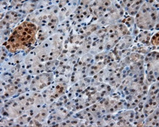 Anti-GBE1 antibody [3B4] used in IHC (Paraffin sections) (IHC-P). GTX84456