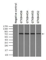 Anti-GBE1 antibody [3B4] used in Immunoprecipitation (IP). GTX84456