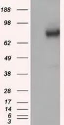 Anti-GBE1 antibody [3B4] used in Western Blot (WB). GTX84456