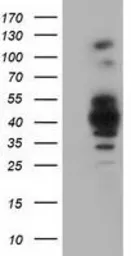 Anti-GAS7 antibody [2F6] used in Western Blot (WB). GTX84462