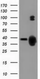 Anti-GAS7 antibody [4E6] used in Western Blot (WB). GTX84465