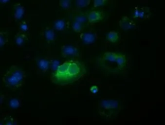 Anti-FSH beta antibody [3A9] used in Immunocytochemistry/ Immunofluorescence (ICC/IF). GTX84474