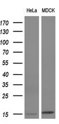 Anti-FSH beta antibody [3A9] used in Western Blot (WB). GTX84474