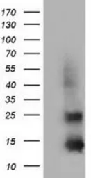 Anti-FSH beta antibody [3A9] used in Western Blot (WB). GTX84474