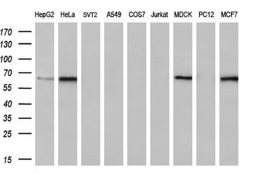Anti-FRK antibody [5F3] used in Western Blot (WB). GTX84484