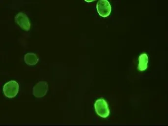 Anti-FOXA2 antibody [3C10] used in Immunocytochemistry/ Immunofluorescence (ICC/IF). GTX84485