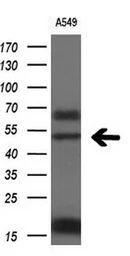 Anti-FOXA2 antibody [3C10] used in Western Blot (WB). GTX84485