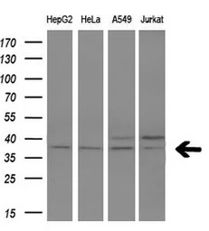 Anti-FKBPL antibody [4G1] used in Western Blot (WB). GTX84490