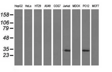 Anti-FHL1 antibody [3G7] used in Western Blot (WB). GTX84494