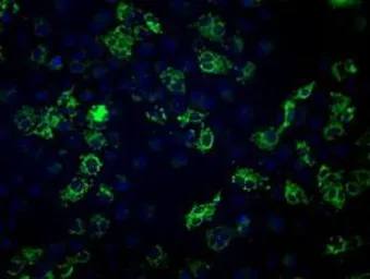 Anti-Fumarate hydratase antibody [9G4] used in Immunocytochemistry/ Immunofluorescence (ICC/IF). GTX84498