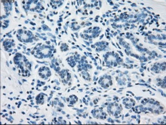 Anti-Fumarate hydratase antibody [9G4] used in IHC (Paraffin sections) (IHC-P). GTX84498