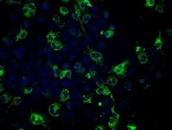 Anti-Fumarate hydratase antibody [2A2] used in Immunocytochemistry/ Immunofluorescence (ICC/IF). GTX84499