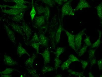 Anti-Fumarate hydratase antibody [2A2] used in Immunocytochemistry/ Immunofluorescence (ICC/IF). GTX84499