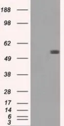 Anti-Fumarate hydratase antibody [2A2] used in Western Blot (WB). GTX84499
