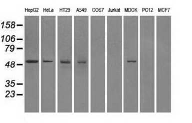 Anti-Fumarate hydratase antibody [2A2] used in Western Blot (WB). GTX84499