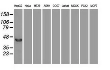 Anti-FGF2 antibody [2H11] used in Western Blot (WB). GTX84501
