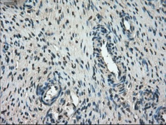Anti-Mig-2 antibody [25A4] used in IHC (Paraffin sections) (IHC-P). GTX84505