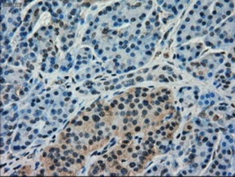 Anti-Mig-2 antibody [25A4] used in IHC (Paraffin sections) (IHC-P). GTX84505